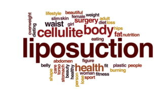 Things You Need To Know About Tampa Liposuction