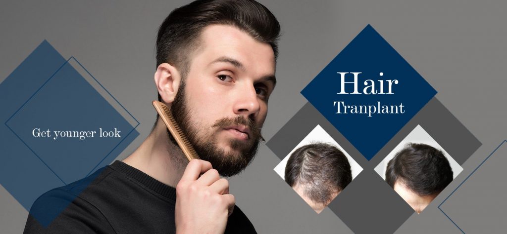 How Successful Is A Hair Transplant