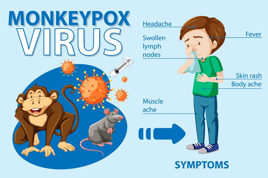 What is Monkeypox and Should You Be Worried?