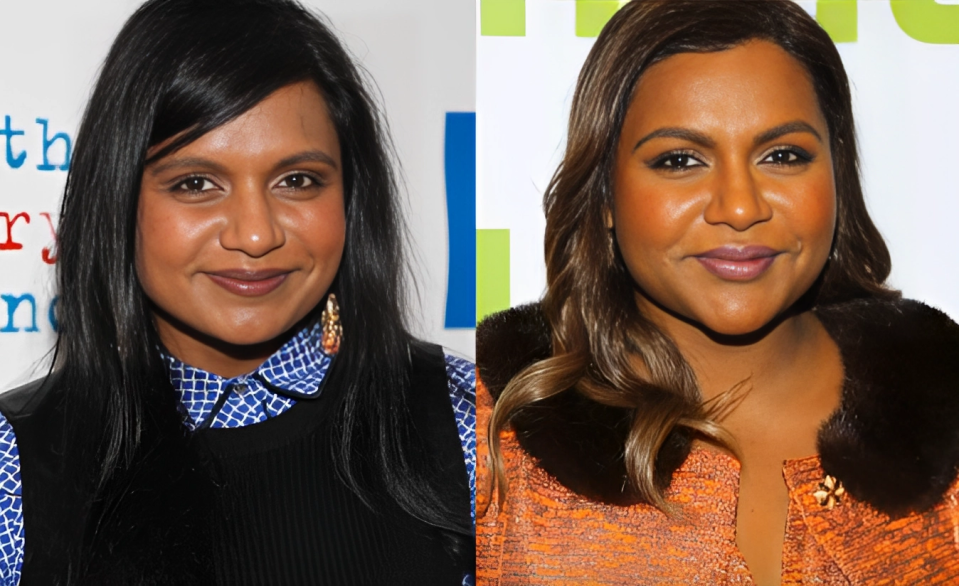 Mindy Kaling Plastic Surgery: Points To Know