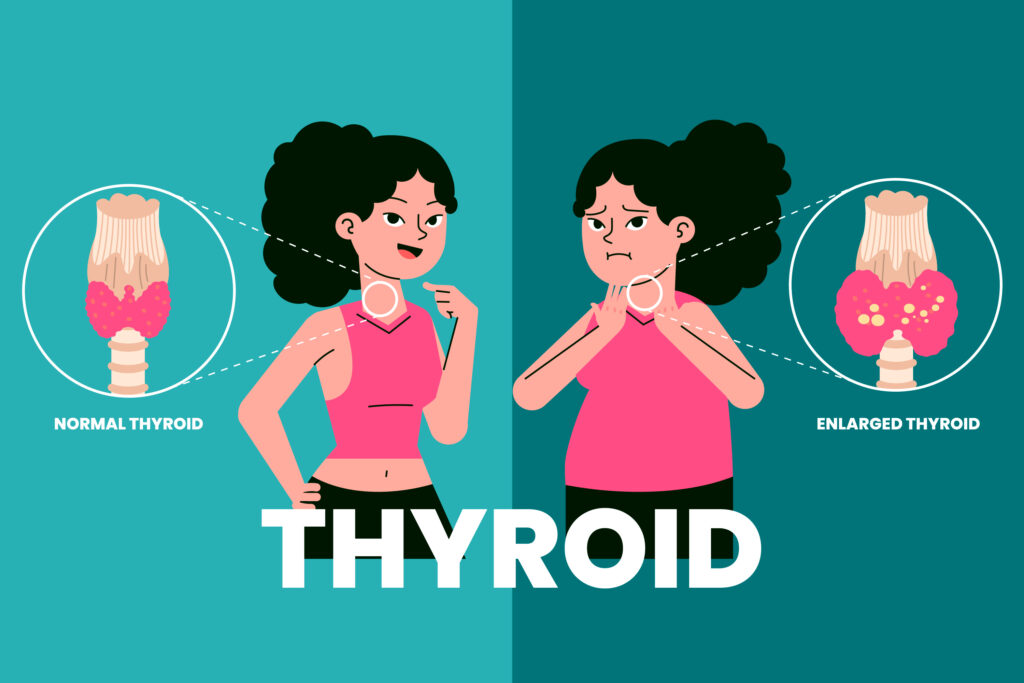thyroid glands