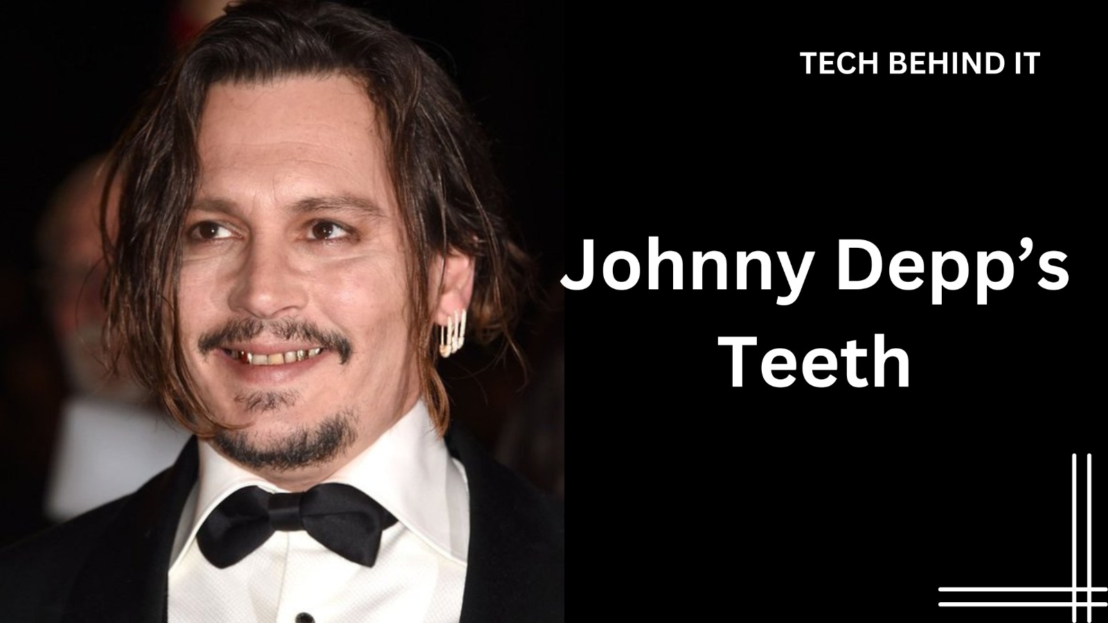 What happened to Johnny Depp’s teeth?