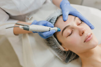 Enhance Your Skin’s Beauty with Microneedling