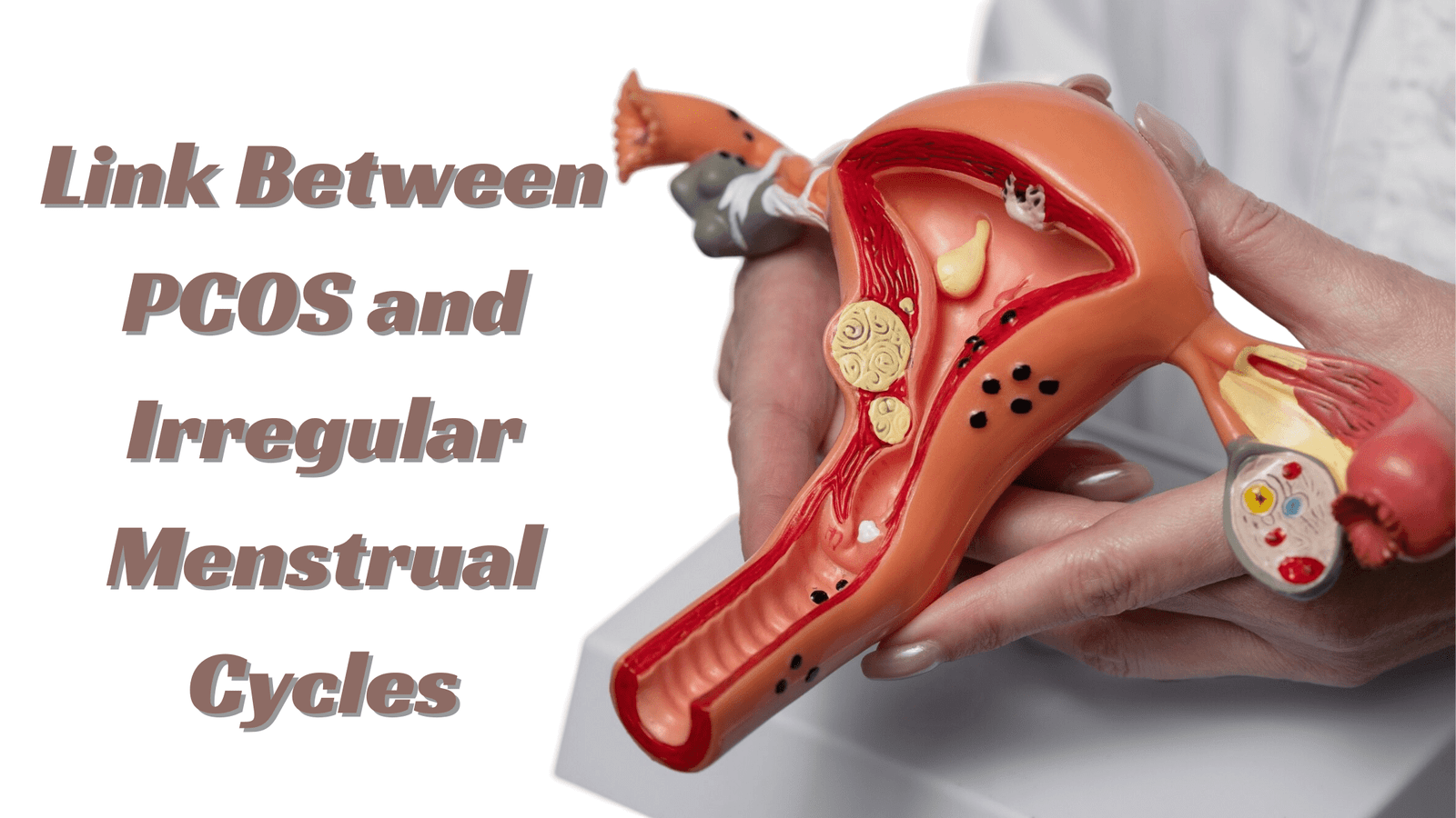 What Is the Link Between PCOS and Irregular Menstrual Cycles?